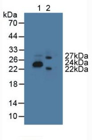 Western Blot; Lane1: Porcine Stomach Tissue; Lane2: Mouse Brain Tissue.