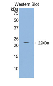 Western Blot; Sample: Recombinant protein.