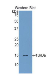 Western Blot; Sample: Recombinant protein.