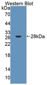 Western Blot; Sample: Recombinant protein.