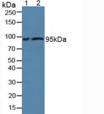 Western Blot; Sample: Lane1: Rat Serum; Lane2: Human Serum.