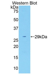 Western Blot; Sample: Recombinant protein.