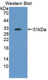 Western Blot; Sample: Recombinant protein.