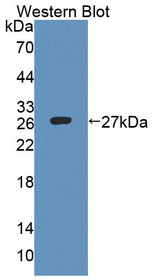 Western Blot; Sample: Recombinant protein.
