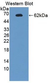 Western Blot; Sample: Recombinant protein.