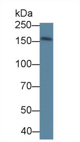 Western Blot; Sample: Mouse Skeletal muscle lysate; Primary Ab: 1µg/ml Rabbit Anti-Mouse DAG1 Antibody Second Ab: 0.2µg/mL HRP-Linked Caprine Anti-Rabbit IgG Polyclonal Antibody