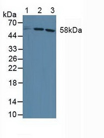 Western Blot; Sample: Lane1: Human HepG2 Cells; Lane2: Human Jurkat Cells; Lane3: Human Hela Cells.