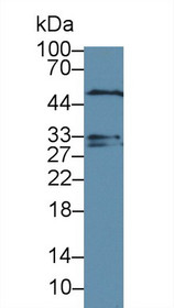 Western Blot; Sample: Rat Cerebrum lysate; Primary Ab: 2µg/ml Rabbit Anti-Rat DTNBP1 Antibody Second Ab: 0.2µg/mL HRP-Linked Caprine Anti-Rabbit IgG Polyclonal Antibody