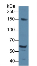 Western Blot; Sample: Rat Serum; Primary Ab: 1µg/ml Rabbit Anti-Rat DOK1 Antibody Second Ab: 0.2µg/mL HRP-Linked Caprine Anti-Rabbit IgG Polyclonal Antibody