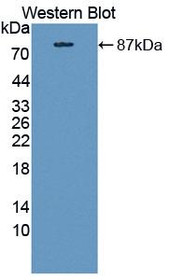 Western Blot; Sample: Recombinant protein.