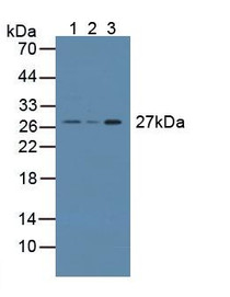 Western Blot; Sample: Lane1: Mouse Testis Tissue; Lane2: Rat Prostate Gland Tissue; Lane3: Rat Testis Tissue.