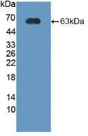 Western Blot; Sample: Recombinant CRHBP, Rat.