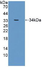 Western Blot; Sample: Recombinant CRAT, Human.