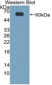Western Blot; Sample: Recombinant protein.