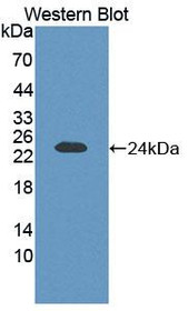 Western Blot; Sample: Recombinant protein.