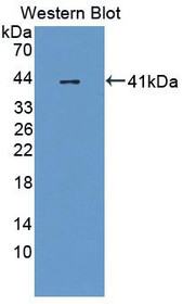 Western Blot; Sample: Recombinant protein.