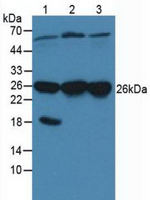 Western Blot; Sample: Lane1: Porcine Brain Tissue; Lane2: Human Hela Cells; Lane3: Human A431 Cells.