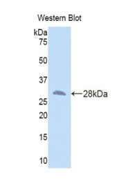 Western Blot; Sample: Recombinant protein.