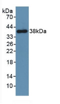 Western Blot; Sample: Recombinant PDGFRb, Mouse.