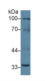 Western Blot; Sample: Mouse Liver lysate; Primary Ab: 2µg/ml Rabbit Anti-Mouse RANk Antibody Second Ab: 0.2µg/mL HRP-Linked Caprine Anti-Rabbit IgG Polyclonal Antibody