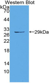 Western Blot; Sample: Recombinant protein.