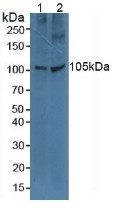 Western Blot; Sample: Lane1: Human A549 Cells; Lane2: Human Hela Cells.