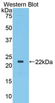 Western Blot; Sample: Recombinant protein.