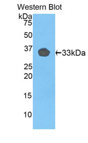 Western Blot; Sample: Recombinant protein.