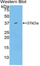 Western Blot; Sample: Recombinant protein.