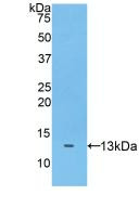 Western Blot; Sample: Recombinant ADAMTS7, Human.