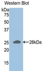 Western Blot; Sample: Recombinant protein.