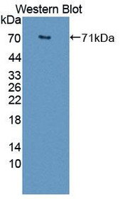 Western Blot; Sample: Recombinant protein.