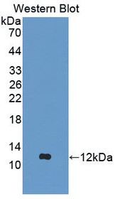 Western Blot; Sample: Recombinant protein.