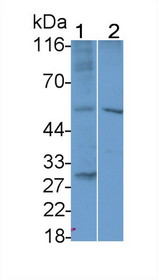 Western Blot; Sample: Recombinant protein.