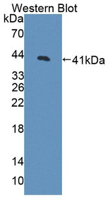 Western Blot; Sample: Recombinant protein.