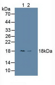 Western Blot; Sample: Lane1: Human HepG2 Cells; Lane2: Human Hela Cells.