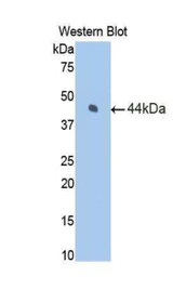 Western Blot; Sample: Recombinant protein.