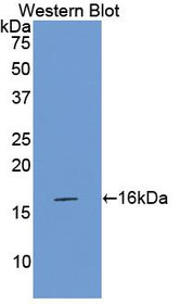 Western Blot; Sample: Recombinant protein.