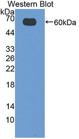 Western Blot; Sample: Recombinant protein.