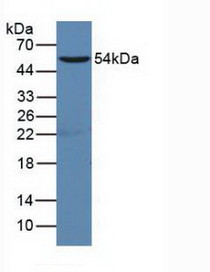 Western Blot; Sample:Human Raji Cells.