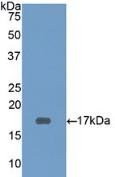 Western Blot; Sample: Recombinant CD3d, Human.