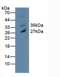 Western Blot; Sample: Human U-87MG Cells.