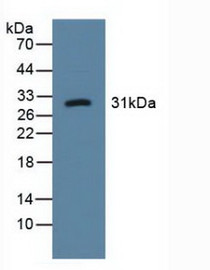Western Blot; Sample: Human Urine.