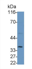 Interleukin 2 Receptor Alpha (IL2Ra) Polyclonal Antibody, CAU25208
