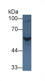 Western Blot; Sample: Rat Serum; Primary Ab: 1µg/ml Rabbit Anti-Rat SHH Antibody Second Ab: 0.2µg/mL HRP-Linked Caprine Anti-Rabbit IgG Polyclonal Antibody