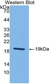 Western Blot; Sample: Recombinant protein.