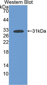 Western Blot; Sample: Recombinant protein.