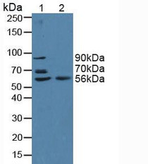 Western Blot; Sample: Lane1: Human Serum; Lane2: Human Hela Cells.