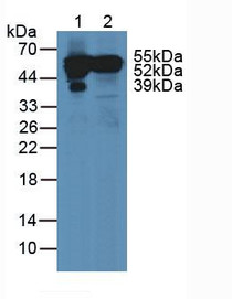 Western Blot; Sample: Lane1: Human Serum; Lane2: Human Liver Tissue.