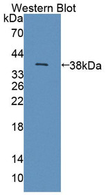 Western Blot; Sample: Recombinant protein.